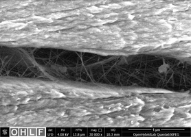 Bakterielle Nanocellulose zwischen zwei Schichten (LFD-Detektor, 30.000-fache Vergrößerung) zeigt Vernetzungsreaktionen.